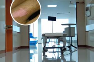 黑色素減少的癥狀表現